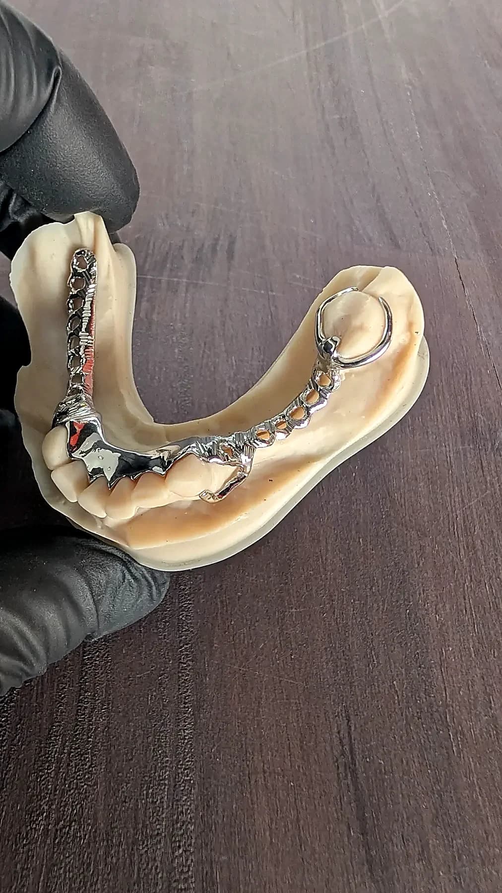 A finished lower cobalt-chrome framework fitted to a dental model